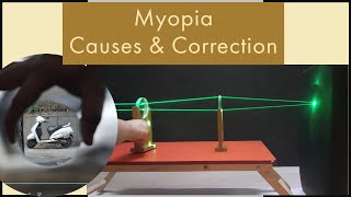 Defects of vision  Myopia  Hypermetropia  Pressbiopia  Astigmatism  class 12th Physics [upl. by Yarvis605]