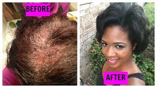 How To Grow Out Your Hair Longer amp Faster [upl. by Spence]