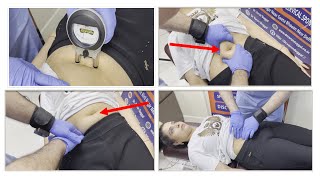 7 years old gas problem  navel displacement cured with chiropractic  chiropractic in Delhi [upl. by Anaig]