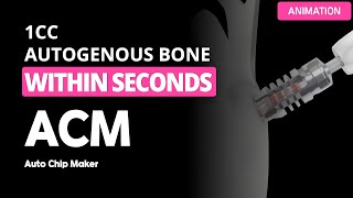 Easy way to get autogenous bone within seconds ACM Auto chip maker [upl. by Yatnohs]