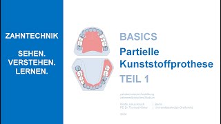 Partielle Kunststoffprothese  Teil 1 [upl. by Ennovi]