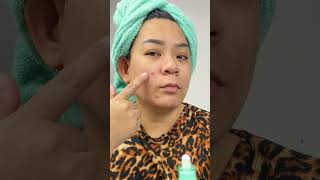 For Acne Prone and Sensitive Skin  AXIS  Y blemish spot Treatment [upl. by Ladiv]