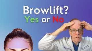 Benefits of Brow Lift Surgery  Plastic Surgeon Explains EyeBrow Lifts [upl. by Maleeny]