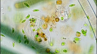 Freshwater Hypotrich  Possibly Euplotes [upl. by Lounge]