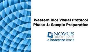 Western Blot Visual Protocol Phase 1 Sample Preparation [upl. by Deryl]