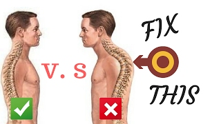 3 تمارين لعلاج تقوس الظهر الأتب kyphosis treatment [upl. by Ailaham]