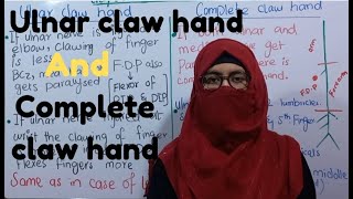 Difference between ulnar claw hand and complete claw hand  clinical anatomy of ulnar nerve [upl. by Janeta]