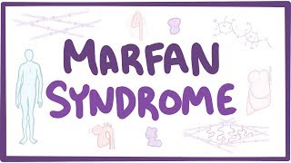 Marfan Syndrome  causes symptoms diagnosis treatment pathology [upl. by Squires]