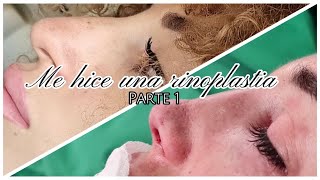 Mi Experiencia con la RINOPLASTIA👃🏼  Proceso Part 1 [upl. by Nicolai977]