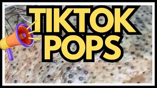 TikTok PIMPLES Popped [upl. by Nodyarg422]