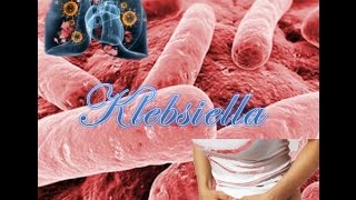 Klebsiella [upl. by Jannelle]