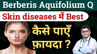 Berberis Aquifolium Homeopathic medicine for MiLIA Acne N fairness milia acne pimplesfairness [upl. by Gasser]