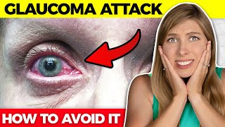 Emergency Eye Condition Everyone Should KnowAll You Need To Know About Acute Angle Closure Glaucoma [upl. by Rehpotsirahc]