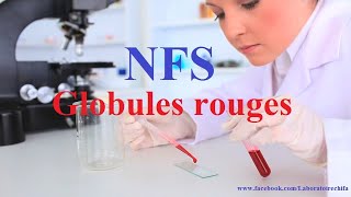 NFS Globules rouges [upl. by Essilrahc480]