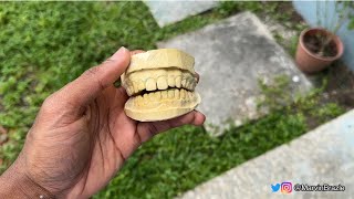 How to make a mold of your teeth grillz dental impression [upl. by Cheyne]