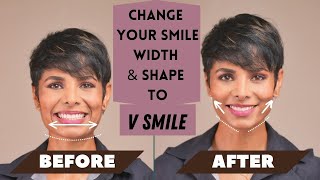 How to CHANGE Your SMILE Width and Shape to V SMILE [upl. by Arrekahs998]