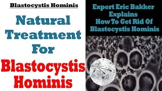 Blastocystis Hominis Treatment Natural Treatment For Blastocystis Hominis  Ask Eric Bakker [upl. by Yehsa]