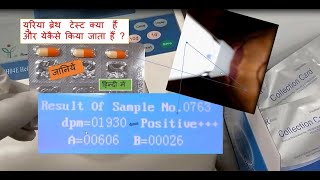 Urea breath test in Hindi  UBT  Urea breath test Positive  Urea breath test procedure [upl. by Nalorac]