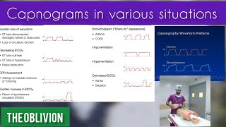 End tidal Carbon DioxideCO2 Monitoring Capnograms in various situationsmedicalEtCO2anaesthetic [upl. by Hanoj455]