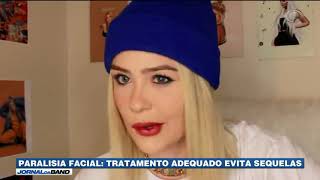 Paralisia facial tratamento adequado evita sequelas [upl. by Ardnael]