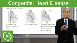 Congenital Heart Disease  Cardiology [upl. by Attenyt]