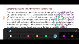 chapter 160 tintinalli emergency medicine head trauma [upl. by Huntingdon]