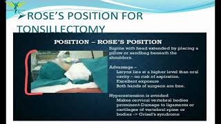 Tonsillectomy  ENT Steps  Indications and contradictions  post operative care  Complications [upl. by Aneger467]