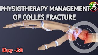 Day 29  physiotherapy management of collis fracture  collis fracture management [upl. by Odessa339]