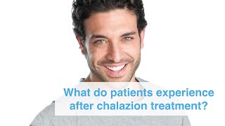 What do patients experience after chalazion incision and curettage surgery at Clinica London [upl. by Jara686]