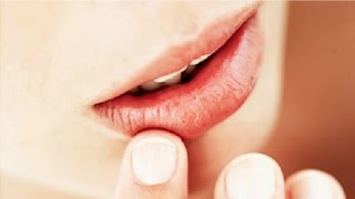 The Basics Canker Sore Causes and Treatments [upl. by Trixi585]