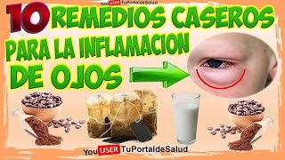 Como Curar la Inflamación de Ojos o Blefaritis con 10 Remedios Caseros [upl. by Mattheus199]