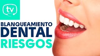 Todo sobre el blanqueamiento dental y sus riesgos [upl. by Enecnarf]