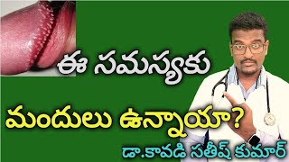 How to Cure pearl penile papule Telugu  Doctor Satheesh  Yes1TV LifeCare [upl. by Arelc]