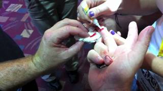 How to seal a wound with Super Glue starring Paul Whitby [upl. by Ecylahs452]