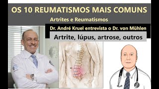 OS 10 REUMATISMOS MAIS COMUNS como diagnosticar e tratar [upl. by Dorothee483]