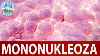 Mononukleoza Uzrok i pomoć Dr79 [upl. by Hanselka]