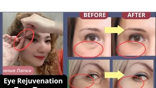 ANTIAGING FACE EXERCISES FOR EYE BAGS EYE WRINKLES DARK CIRCLES amp TIGHTEN DROOPY EYELIDS set [upl. by Jolee]