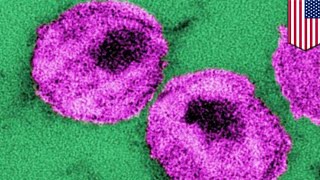 HIV cure New molecule can kick and kill dormant HIV cells hiding in the body  TomoNews [upl. by Osi]