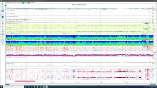 Persyst 14 Overview [upl. by Anaerb]