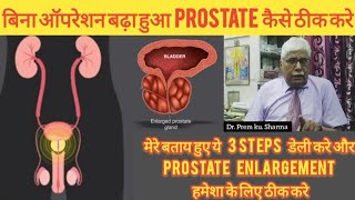 बिना ऑपरेशन बढ़ा हुआ PROSTATE कैसे ठीक करेमेरे बताए हुए ये 3 steps डेली करेDrprem kusharma [upl. by Toile]