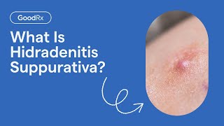 Hidradenitis Suppurativa Explained Symptoms Causes and Complications  GoodRx [upl. by Matthieu]