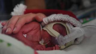 NICU nurses sing holiday carol to preemie baby [upl. by Elga]