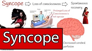 Syncope and Fainting Syncope Types and Treatment Simply explained [upl. by Sabina168]