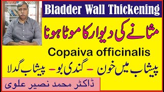 Bladder Wall Thickeningمثانے کی دیوار کا موٹا ہونا۔مثانے کی سوزش ۔ Copaiva officinalis [upl. by Tobe]