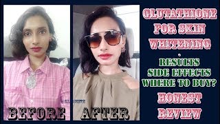 Glutathione Skin Whitening Tablets Results  Genuine Customer Review  SahiJeeth [upl. by Nuarb]