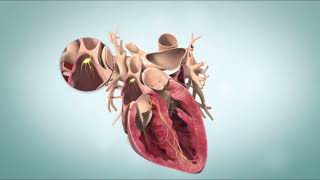 Ventricular Fibrillation VFib Terminal Cardiac Rhythm [upl. by Eelyac]