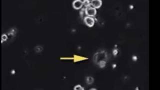 Bacteria Cell cytolysis with video cell division [upl. by Sama]