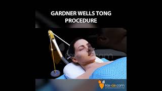 Gardner Wells Tong Procedure [upl. by Alled189]