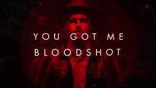 Sam Tinnesz  Bloodshot Official Lyric Video [upl. by Hartfield780]