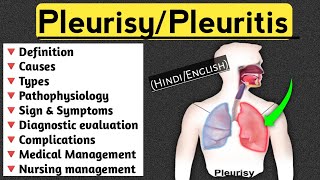 PleurisyPleuritis lecture in Hindi and English medical nursingcriteria pleuritis paramedical [upl. by Dnomder]